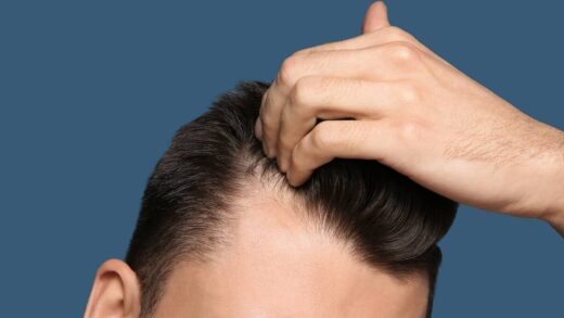 Jak zaradzić nadmiernemu wypadaniu włosów